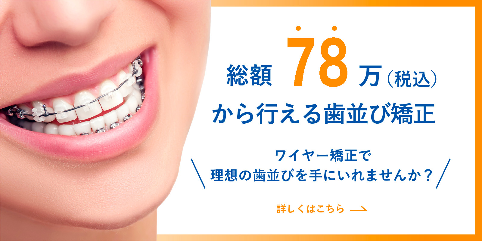 総額66万円から始める歯列矯正